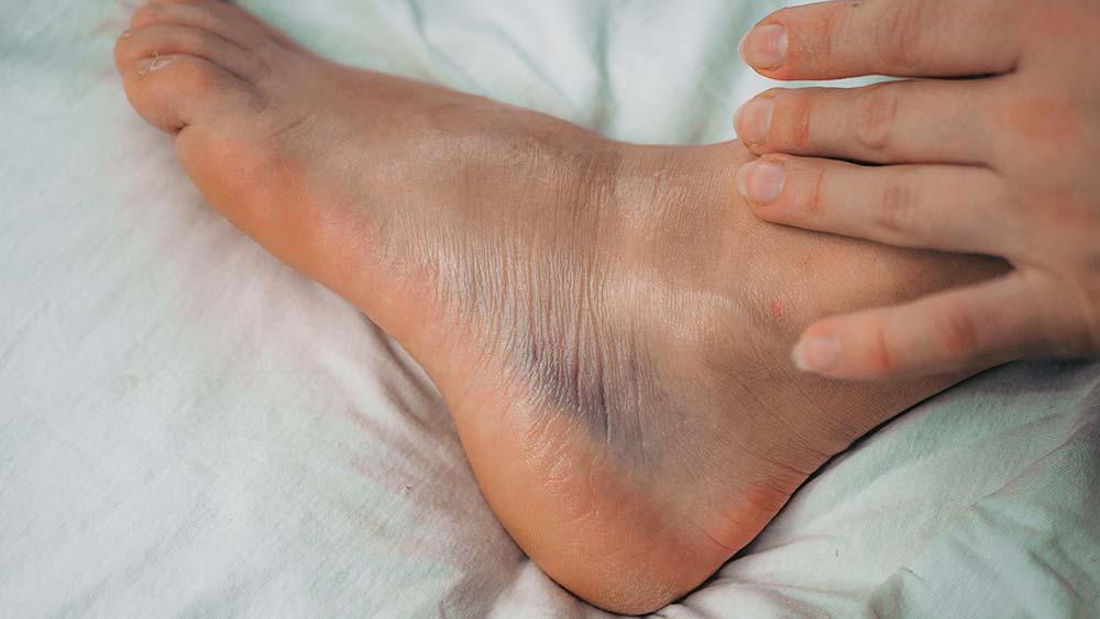 how long does it take for a sprained ankle to heal